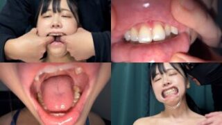 すずちゃんの口内観察